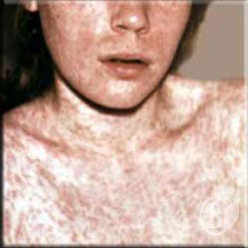 ��� ������ ����������� ������ �������������  � ������� �� �� 