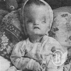 2-річна Оксана хоче жити… Допоможіть! (фото) 2-річна Оксана хоче жити… Допоможіть! (фото)