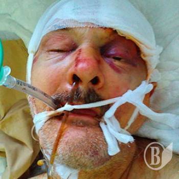 Допоможіть встановити особу збитого велосипедиста! Допоможіть встановити особу збитого велосипедиста!