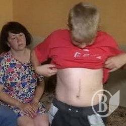 Триває розслідування щодо випадку з відбитою селезінкою школяра Триває розслідування щодо випадку з відбитою селезінкою школяра