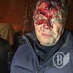 Порошенко з Аваковим наступили на граблі Януковича й погромили намети протестувальників Порошенко з Аваковим наступили на граблі Януковича й погромили намети протестувальників