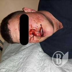 Когось відлупцювали в алкогольному гадючнику Когось відлупцювали в алкогольному гадючнику