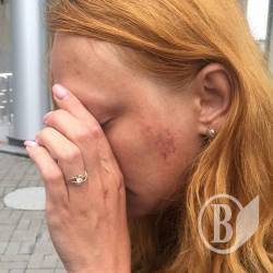 Поліцейський відлупцював жінку Поліцейський відлупцював жінку
