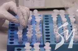У Житомирі зафіксовано перший випадок коронавірусу У Житомирі зафіксовано перший випадок коронавірусу