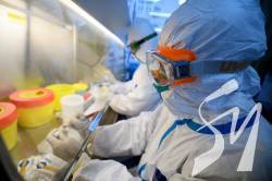    COVID-19   4161 , 116  