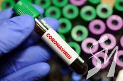    COVID-19   4662,   125 - 