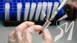 Названо найбільш захищену від коронавірусу групу крові Названо найбільш захищену від коронавірусу групу крові