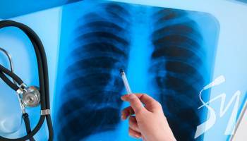  1500        ,   72 -  