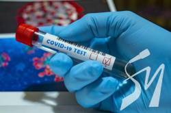     15 579   COVID-19,     - 237