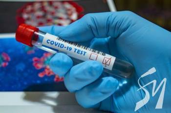     15 579   COVID-19,     - 237