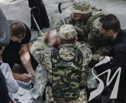Операція тривала майже 7 годин: в якому стані постраждалий від вибуху на Валу дворічний хлопчик Операція тривала майже 7 годин: в якому стані постраждалий від вибуху на Валу дворічний хлопчик