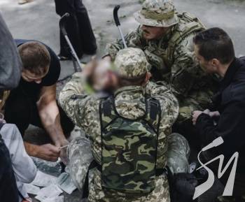Операція тривала майже 7 годин: в якому стані постраждалий від вибуху на Валу дворічний хлопчик Операція тривала майже 7 годин: в якому стані постраждалий від вибуху на Валу дворічний хлопчик