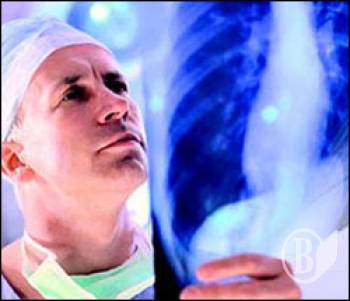  ����������� �� ����������� ������ �����������?