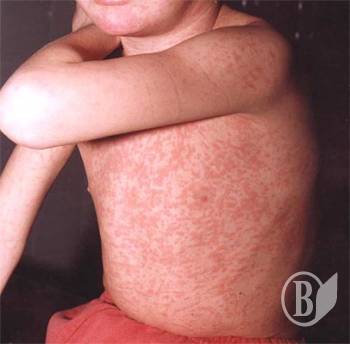 ʳ� ��������� �� ���������?