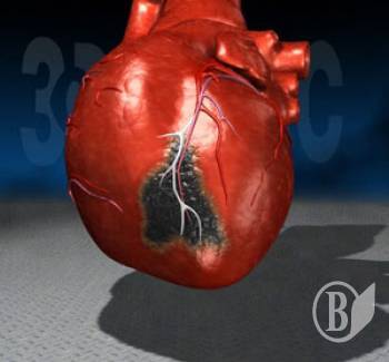 ���������� ����������. ���� �� �� ��������, �������� � ���