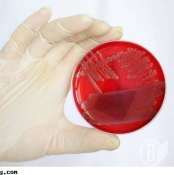 ������ ���������?