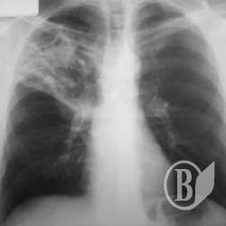 ������� ������� ������