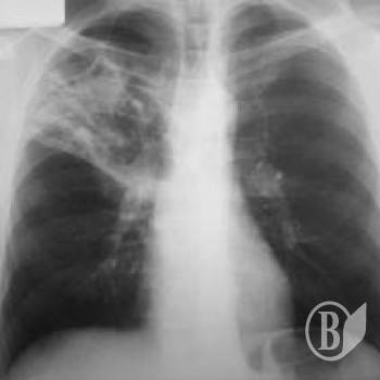 ������� ������� ������