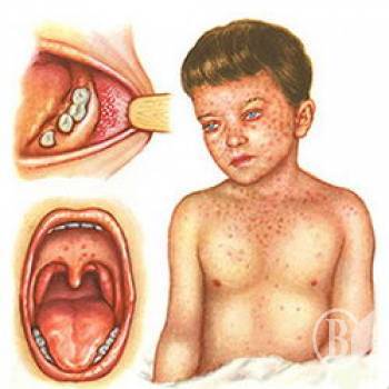 ³� ���� ���������� 380 �����