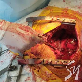 ������� ����� 3 ��� �������� ��������� � �������� ������