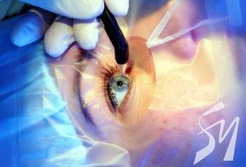 ������� �������� ����