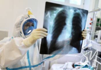 �������� ������ COVID-19 �������, ����� ��������� ��������� ����������