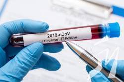 �� ����������� �� ������� ������������� 63 ����� � COVID-19